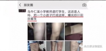 体罚学生何时休？兼评浙江永嘉事件